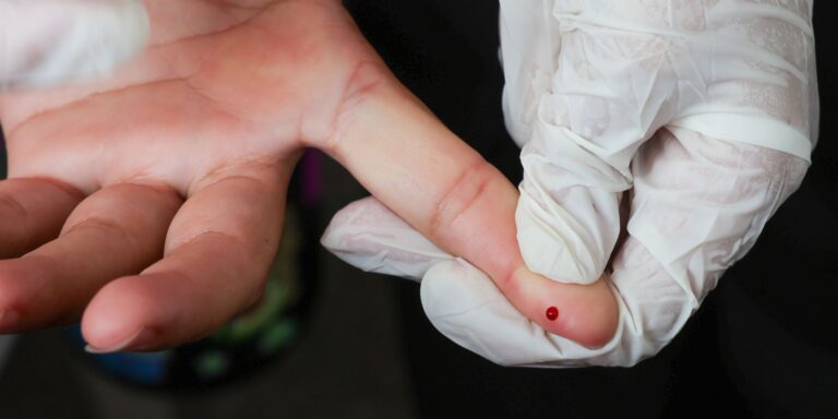 teste-rapido-de-dengue-passa-a-integrar-tabela-do-sus