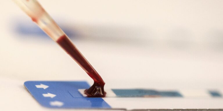 estudo-inedito-da-fiocruz-pode-ampliar-prevencao-de-hiv-entre-jovens