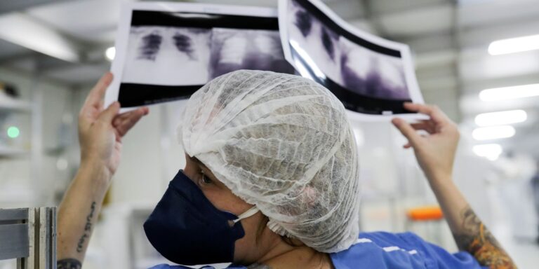 Diagnóstico tardio dá poucas chances de cura do câncer de pulmão diagnostico-tardio-da-poucas-chances-de-cura-do-cancer-de-pulmao