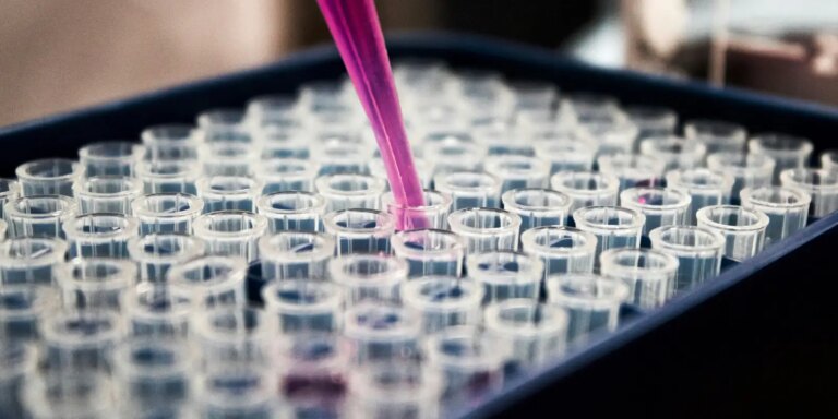 Diagnóstico precoce da AME é divisor de águas, afirma paciente diagnostico-precoce-da-ame-e-divisor-de-aguas,-afirma-paciente